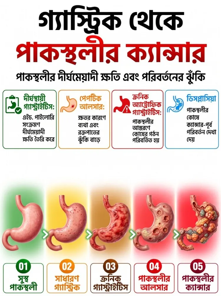 গ্যাস্ট্রিক থেকে পাকস্থলীর ক্যান্সার সচেতনতা ইনফোগ্রাফিক